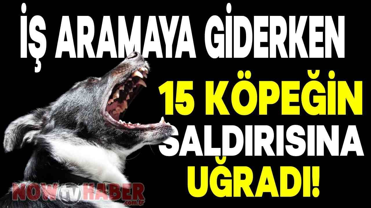 İş Aramaya Giderken 15 Köpeğin Saldırısına Uğradı! Kaldırıldığı Hastaneden Acı Haber Geldi!